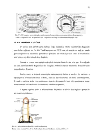 11
10 MICROSSISTEMA PÊNIS
De acordo com a MTC certa parte do corpo é capaz de refletir o corpo todo. Seguindo
essa linha explicada por Dr. Wu Tuo Kwang em seu DVD, este microssistema pode ser usado
para diagnóstico e tratamento partindo do princípio de observação dos sinais e desarmonias
energéticas em determinada área do pênis.
Quando o exame macroscópico do pênis detecta alterações da pele que, dependendo
da área, permitem fazer diagnóstico das afecções, podemos efetuar tratamento de acordo com
os parâmetros descritos.
Porém, como se trata de uma região extremamente íntima e sensível do paciente, a
aplicação da técnica neste local se torna, além de desconfortável, um tanto constrangedora,
levando o paciente a não concordar com a terapia. Acontecendo isso, o terapeuta deve lançar
mão de outros microssistema ou uma nova conduta terapêutica.
A figura seguinte exibe o microssistema do pênis e a relação dos órgãos e partes do
corpo correspondentes.
7 MATERIAIS E MÉTODOS
Fig.07 e 08. Locais a serem injetados medicamentos homeopáticos com os meridianos da acupuntura.
Fonte: Acupuntura Pro: Acupuntura Oral. Disponível em: http://acupunturapro.blogspot.com.
Fig.09 - Microssistema do pênis com áreas do corpo
Fonte: Chia, Mantak;Wei, W.U. Reflexologia Sexual. São Paulo, Cultrix, 2005, p.44
 