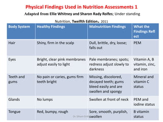 Physical Findings Used in Nutrition Assessments 1
         Adapted from Ellie Whitney and Sharon Rady Rolfes; Under standing
                                                        .
                           Nutrition, Twelfth Edition 2011
Body System     Healthy Findings                Malnutrition Findings           What the
                                                                                Findings Refl
                                                                                ect
Hair            Shiny, firm in the scalp          Dull, brittle, dry, loose;    PEM
                                                  falls out

Eyes            Bright, clear pink membranes Pale membranes; spots;             Vitamin A, B
                adjust easily to light       redness adjust slowly to           vitamin, zinc,
                                             darkness                           and iron
Teeth and       No pain or caries, gums firm      Missing, discolored,          Mineral and
gums            teeth bright                      decayed teeth; gums           vitamin C
                                                  bleed easily and are          status
                                                  swollen and spongy
Glands          No lumps                          Swollen at front of neck      PEM and
                                                                                iodine status
Tongue          Red, bumpy, rough                     Sore, smooth, purplish,   B vitamin
                                                      swollen
                                       Dr. Siham Gritly                         status
 