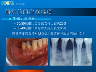 Frs Rpd 14.periodontal and preprosthetic aspects of rpd treatment (n) | PDF