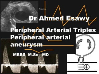 14 peripheral arterial triplex ultrasound  arterial aneurysm dr ahmed esawy