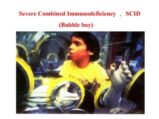 Severe Combined Immunodeficiency ， SCID (Bubble boy) 