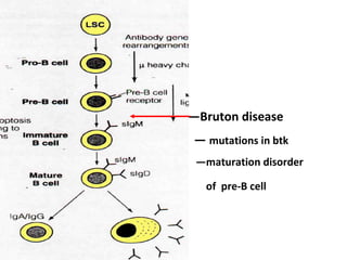 — Bruton disease —  mutations in btk — maturation disorder of  pre-B cell   
