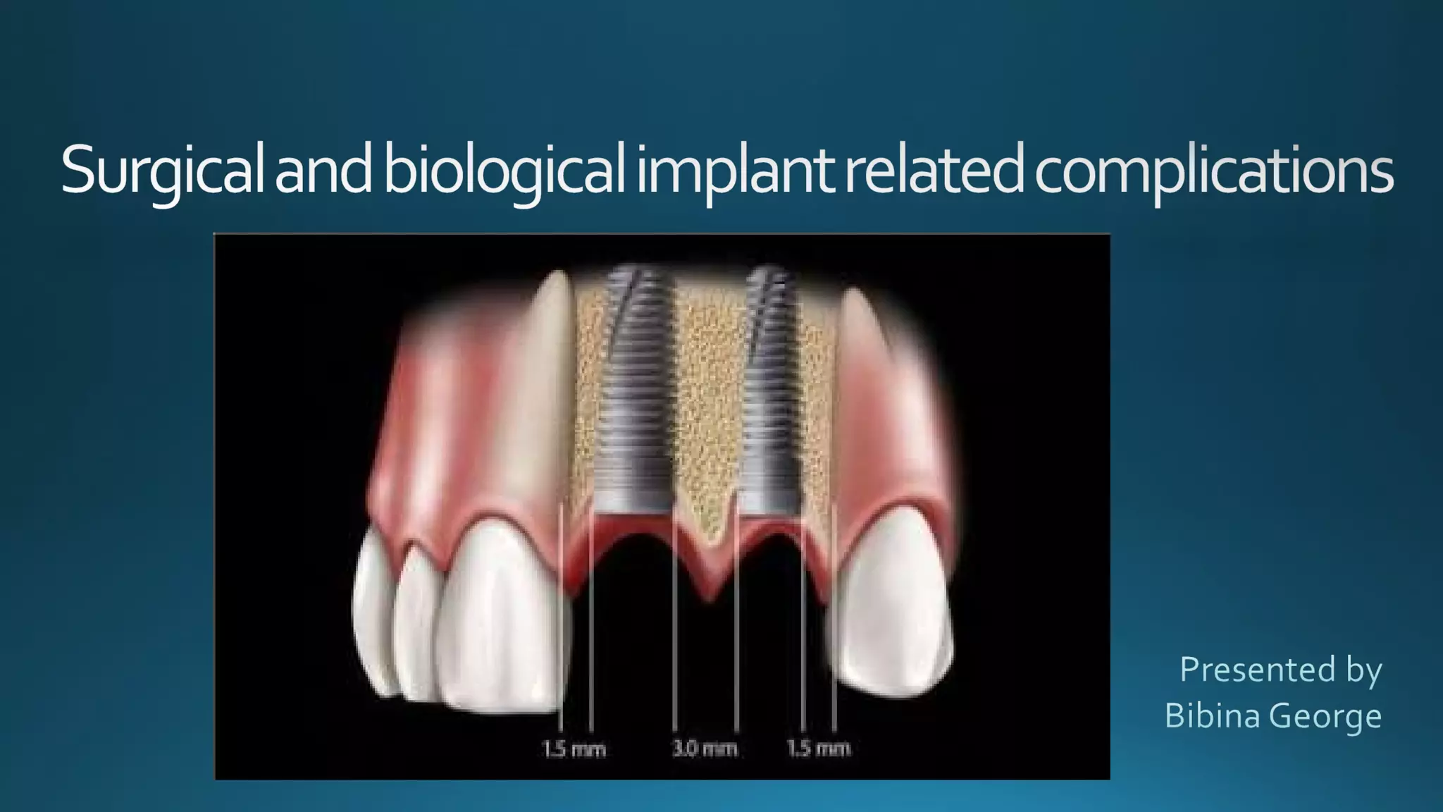 Surgical and biological implant related complications | PPT