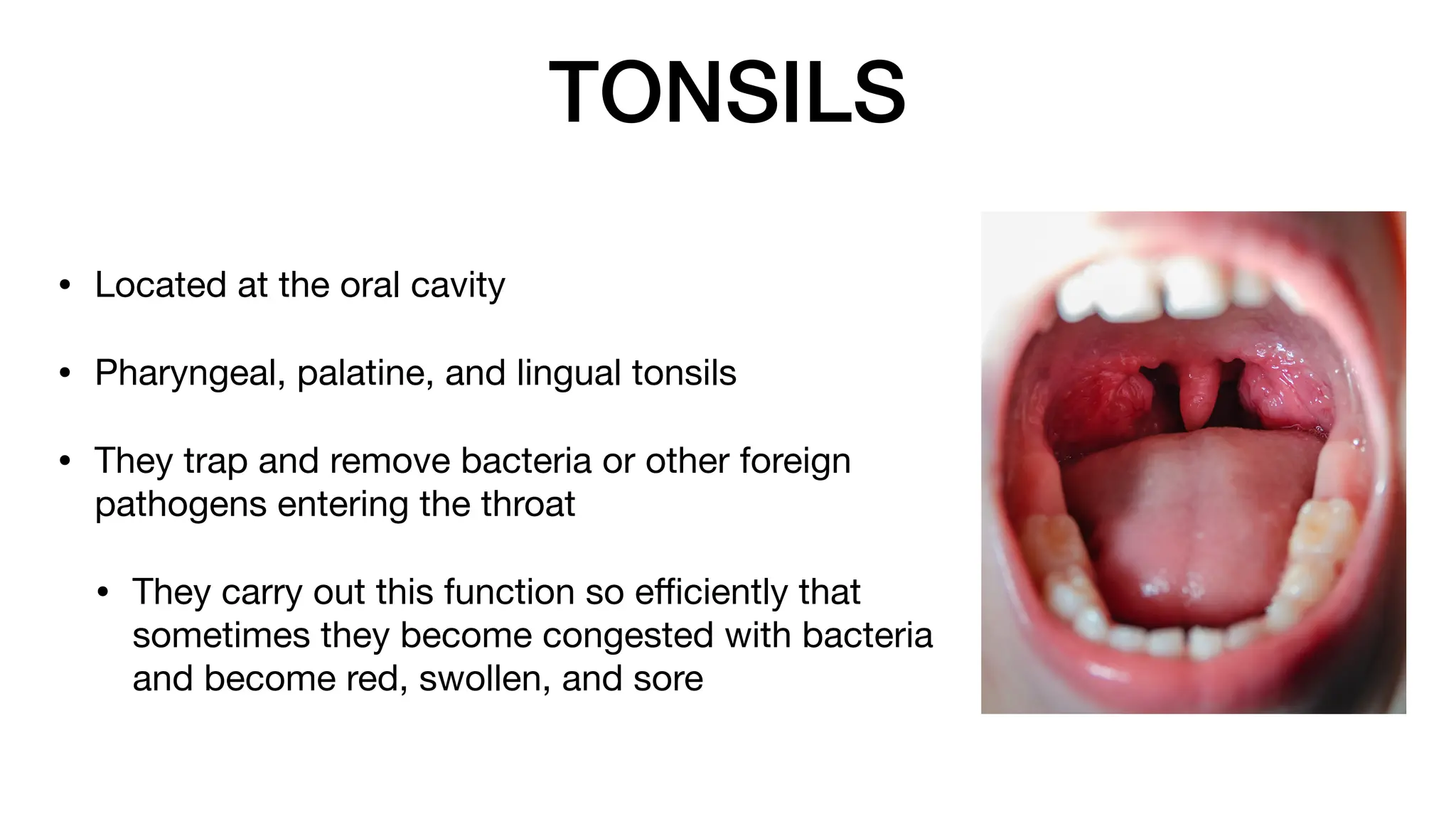TONSILS
• Located at the oral cavity
• Pharyngeal, palatine, and lingual tonsils
• They trap and remove bacteria or other foreign
pathogens entering the throat
• They carry out this function so e
ffi
ciently that
sometimes they become congested with bacteria
and become red, swollen, and sore
 
