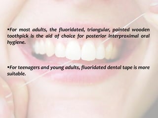  c
topical fluorides 108
For most adults, the fluoridated, triangular, pointed wooden
toothpick is the aid of choice for posterior interproximal oral
hygiene.
For teenagers and young adults, fluoridated dental tape is more
suitable.
 