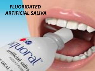  c
topical fluorides 109
FLUORIDATED
ARTIFICIAL SALIVA
 