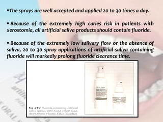  c
topical fluorides 111
The sprays are well accepted and applied 20 to 30 times a day.
 Because of the extremely high caries risk in patients with
xerostomia, all artificial saliva products should contain fluoride.
 Because of the extremely low salivary flow or the absence of
saliva, 20 to 30 spray applications of artificial saliva containing
fluoride will markedly prolong fluoride clearance time.
 