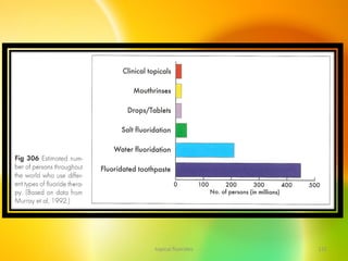 topical fluorides 115
 