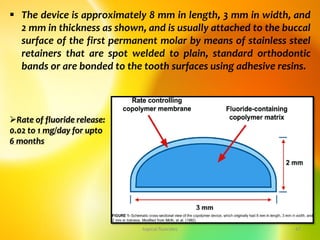  The device is approximately 8 mm in length, 3 mm in width, and
2 mm in thickness as shown, and is usually attached to the buccal
surface of the first permanent molar by means of stainless steel
retainers that are spot welded to plain, standard orthodontic
bands or are bonded to the tooth surfaces using adhesive resins.
topical fluorides 47
Rate of fluoride release:
0.02 to 1 mg/day for upto
6 months
 