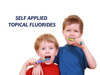 topical fluorides 50
SELF APPLIED
TOPICAL FLUORIDES
 