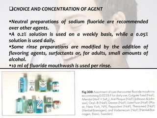  c
topical fluorides 83
CHOICE AND CONCENTRATION OF AGENT
Neutral preparations of sodium fluoride are recommended
over other agents.
A 0.2% solution is used on a weekly basis, while a 0.05%
solution is used daily.
Some rinse preparations are modified by the addition of
flavoring agents, surfactants or, for adults, small amounts of
alcohol.
10 ml of fluoride mouthwash is used per rinse.
 