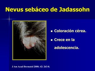 LESIONES PREMALIGNASQueratosis Seborreica Verrugas seborreicas