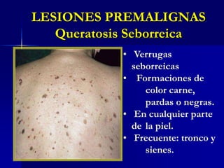  En cualquier parte de 	la piel. 