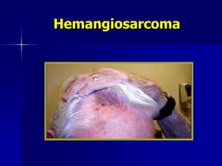 Hemangiosarcoma