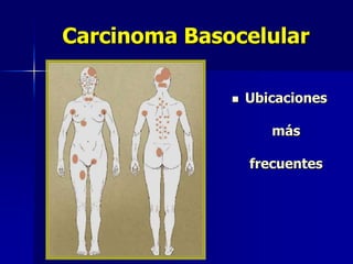  Horas peligrosas.RadiacionesNo-IonizantesIonizantesIones Radioactivos:1.4 % de todos los cánceresLuz ultravioleta:90% Ca. Labios,50% Melanomas,80% de Ca. piel