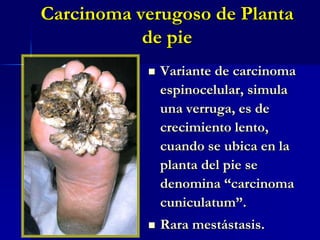 Carcinoma EspinocelularENFERMEDAD DE BOWEN Variedad de Carcinoma espinocelular NTRAEPIDERMICOInvade hasta en un 5% (más infiltrada y nodular).