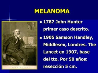 TRATAMIENTO QUIRURGICOCIRUGIA De MOH (1930)