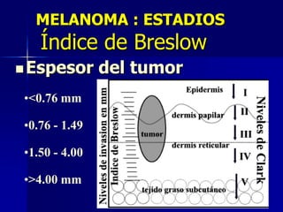 MELANOMA : ESTADIOSNiveles de invasión (de Clark)Nivel I - epidermis , in situ en                        la membrana basal.			         100%Nivel II - dermis papilar a través                   de la membrana basal.  			  96%Nivel III - dermis papilar,                         hasta la interfase reticular. 			   86%Nivel IV - dermis reticular.66%Nivel V - grasa subcutánea.53%