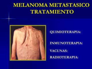 MELANOMA: Márgenes Quirúrgicos<br />D.J. Eedy Surgical Treatment of Melanoma, Br J Dermatol 149(1):2-12, 2003.<br />