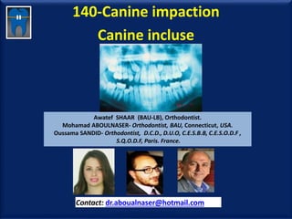 140-Canine impaction
Canine incluse
Awatef SHAAR (BAU-LB), Orthodontist.
Mohamad ABOULNASER- Orthodontist, BAU, Connecticut, USA.
Oussama SANDID- Orthodontist, D.C.D., D.U.O, C.E.S.B.B, C.E.S.O.D.F ,
S.Q.O.D.F, Paris. France.
Contact: dr.aboualnaser@hotmail.com
www.orthofree.com
 