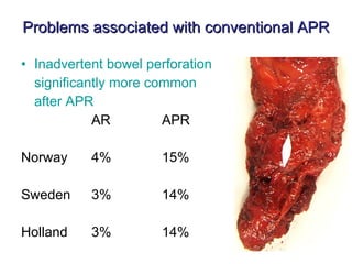 Problems associated with conventional APR Inadvertent bowel perforation significantly more common after APR AR APR Norway 4% 15% Sweden  3% 14% Holland 3% 14% 