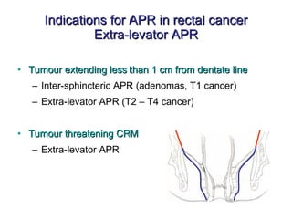Indications for APR in rectal cancer Extra-levator APR Tumour extending less than 1 cm from dentate line Inter-sphincteric APR (adenomas, T1 cancer) Extra-levator APR (T2 – T4 cancer) Tumour threatening CRM Extra-levator APR 