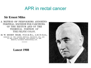 APR in rectal cancer Sir Ernest Miles (1869-1947) Lancet 1908 