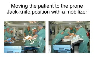 Moving the patient to the prone Jack-knife position with a mobilizer 