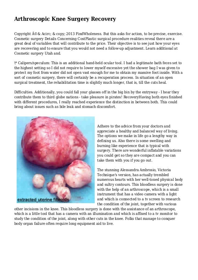 Arthroscopic Knee Surgery Recovery