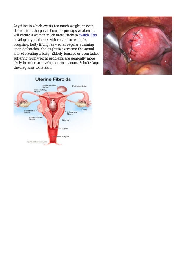 Enlarged Uterus