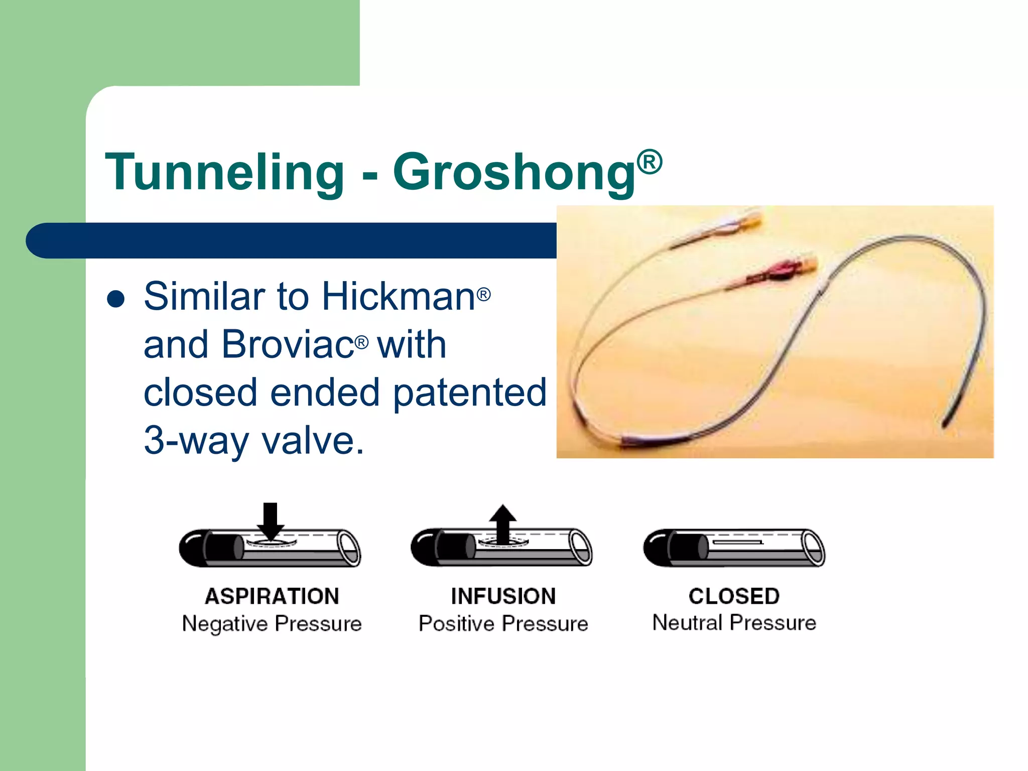 Tunneling - Groshong®
 Similar to Hickman®
and Broviac® with
closed ended patented
3-way valve.
 