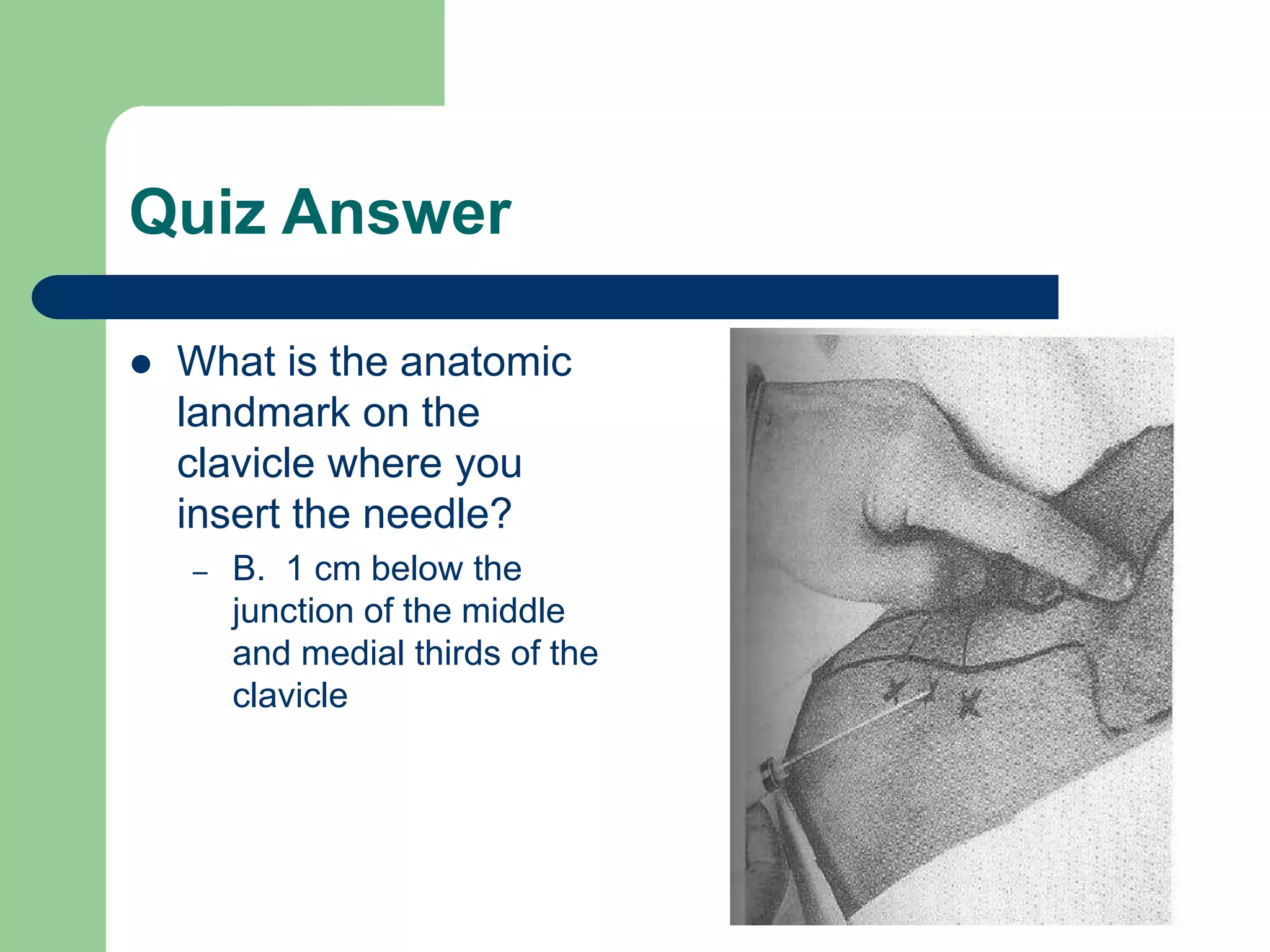 Quiz Answer
 What is the anatomic
landmark on the
clavicle where you
insert the needle?
– B. 1 cm below the
junction of the middle
and medial thirds of the
clavicle
 