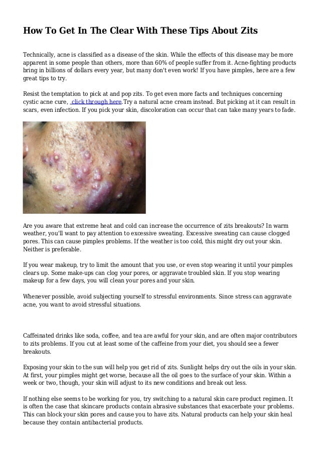 How To Get In The Clear With These Tips About Zits