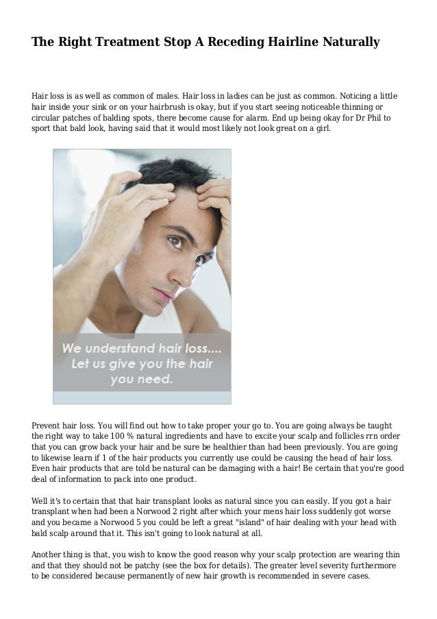 The Right Treatment Stop A Receding Hairline Naturally