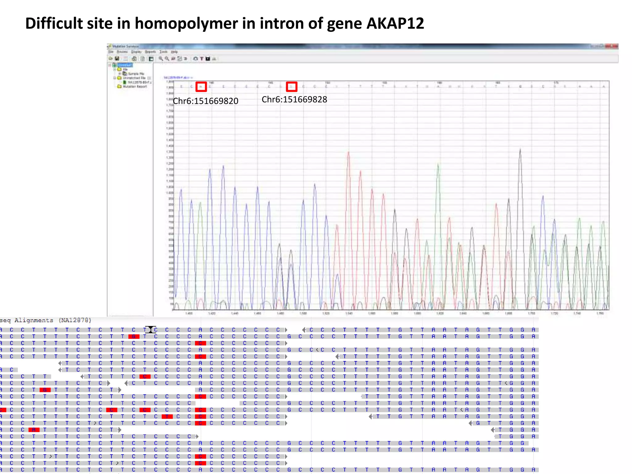 Chr6:151669820 Chr6:151669828
Difficult site in homopolymer in intron of gene AKAP12
 