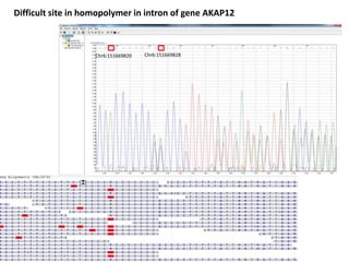 Chr6:151669820 Chr6:151669828
Difficult site in homopolymer in intron of gene AKAP12
 