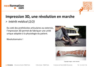 nextformation 55 avenue Hoche 75008 Paris 4 Rue Auber 75009 Paris 9 avenue de Paris 94300 Vincennes Tel : 01 42 03 77 00 
Impression 3D, une révolution en marche 
> Intérêt médical (2/2) 
Du coté des prothésistes articulaires ou externes, 
l’impression 3D permet de fabriquer une unité 
unique adaptée à la physiologie du patient. 
Révolutionnaire ! 
Copyright images : droits réservés 
 