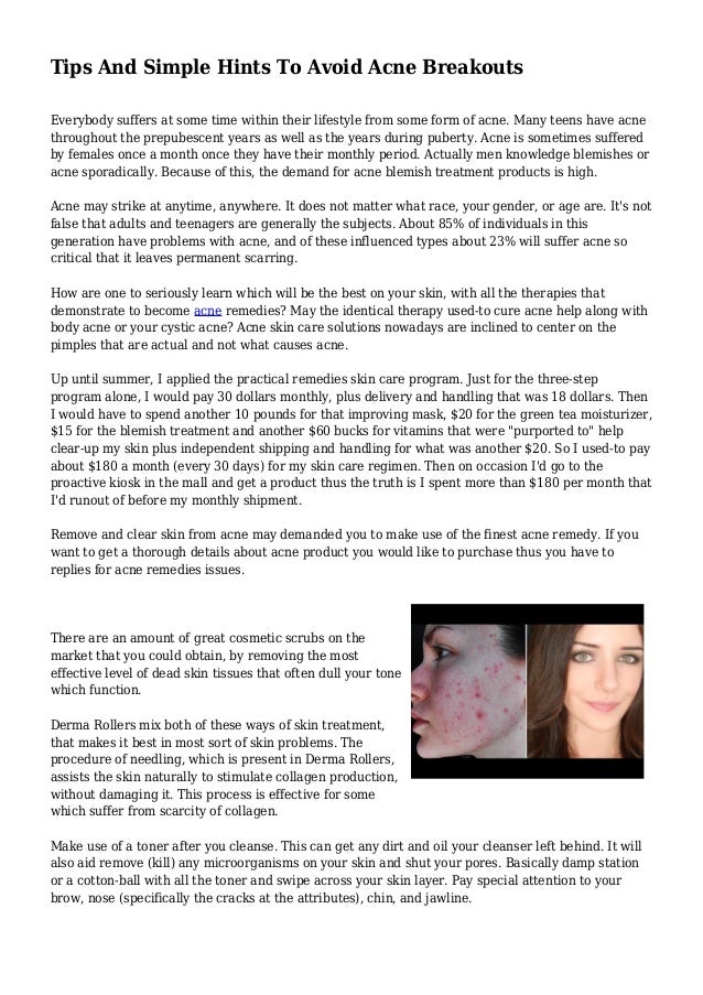 Tips And Simple Hints To Avoid Acne Breakouts 
Everybody suffers at some time within their lifestyle from some form of acn...