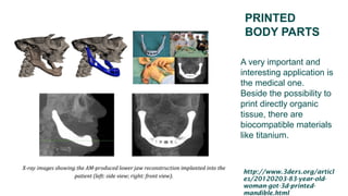 PRINTED
BODY PARTS
A very important and
interesting application is
the medical one.
Beside the possibility to
print directly organic
tissue, there are
biocompatible materials
like titanium.
http://www.3ders.org/articl
es/20120203-83-year-old-
woman-got-3d-printed-
mandible.html
 