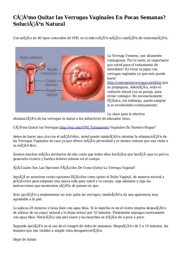 encontrar escolta vaginal encontrar escolta vaginal
