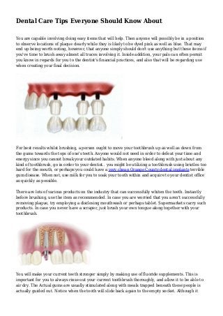 Dental Care Tips Everyone Should Know About 
You are capable involving doing easy items that will help. Then anyone will possibly be in a position 
to observe locations of plaque clearly while they is likely to be dyed pink as well as blue. That may 
end up being worth noting, however, that anyone simply should don't use anything but these items if 
you've time to brush away almost all traces involving it. Inside addition, your pals can often permit 
you know in regards for you to the dentist's financial practices, and also that will be regarding use 
when creating your final decision. 
For best results whilst brushing, a person ought to move your toothbrush up as well as down from 
the gums towards the tops of one's teeth. Anyone would not need in order to defeat your time and 
energy since you cannot break your outdated habits. When anyone bleed along with just about any 
kind of toothbrush, go in order to your dentist.. you might be utilizing a toothbrush using bristles too 
hard for the mouth, or perhaps you could have a very cheap Orange County dental implants terrible 
gum disease. When not, use milk for you to soak your tooth within and acquire to your dentist office 
as quickly as possible. 
There are lots of various products on the industry that can successfully whiten the teeth. Instantly 
before brushing, use the item as recommended. In case you are worried that you aren't successfully 
removing plague, try employing a disclosing mouthwash or perhaps tablet. Supermarkets carry such 
products. In case you never have a scraper, just brush your own tongue along together with your 
toothbrush. 
You will make your current teeth stronger simply by making use of fluoride supplements. This is 
important for you to always rinse out your current toothbrush thoroughly, and allow it to be able to 
air dry. The Actual gums are usually stimulated along with meals trapped beneath these people is 
actually guided out. Notice when the tooth will slide back again to the empty socket. Although it 
 