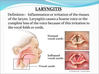 141363130-respiratory-tract-infection.ppt