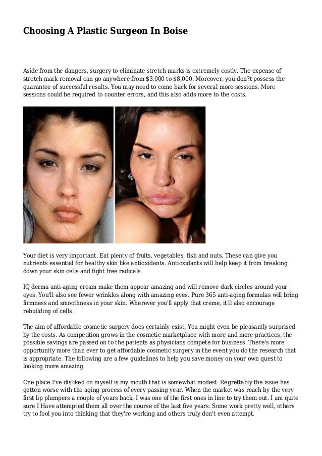 Choosing A Plastic Surgeon In Boise