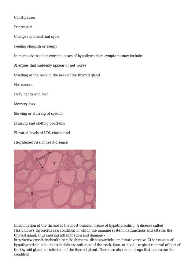 Could hypothyroidism be the cause of your random health ...