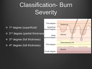 141584757-Burns-Presentation.pptx