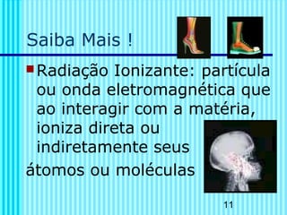 11
Saiba Mais !
Radiação Ionizante: partícula
ou onda eletromagnética que
ao interagir com a matéria,
ioniza direta ou
indiretamente seus
átomos ou moléculas
 