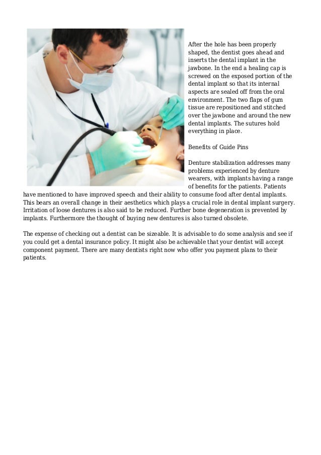 Role of Guide Pins in Dental Implants