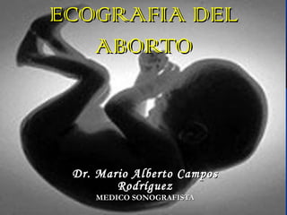 ECOGRAFIA DELECOGRAFIA DEL
ABORTOABORTO
Dr. Mario Alberto CamposDr. Mario Alberto Campos
RodríguezRodríguez
MEDICO SONOGRAFISTAMEDICO SONOGRAFISTA
 