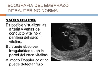 ECOGRAFIA DEL EMBARAZO
INTRAUTERINO NORMAL
SACOVITELINO.
Es posible visualizar las
arteria y venas del
conducto vitelino y
periferia del saco
vitelino.
Se puede observar
irregularidades en la
pared del saco vitelino.
Al modo Doppler color se
puede detectar flujo.
 