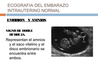 ECOGRAFIA DEL EMBARAZO
INTRAUTERINO NORMAL
EMBRION Y AMNIOS
SIGNO DE DOBLE
BURBUJA.
Representan el amnios
y el saco vitelino y el
disco embrionario se
encuentra entre
ambos.
 